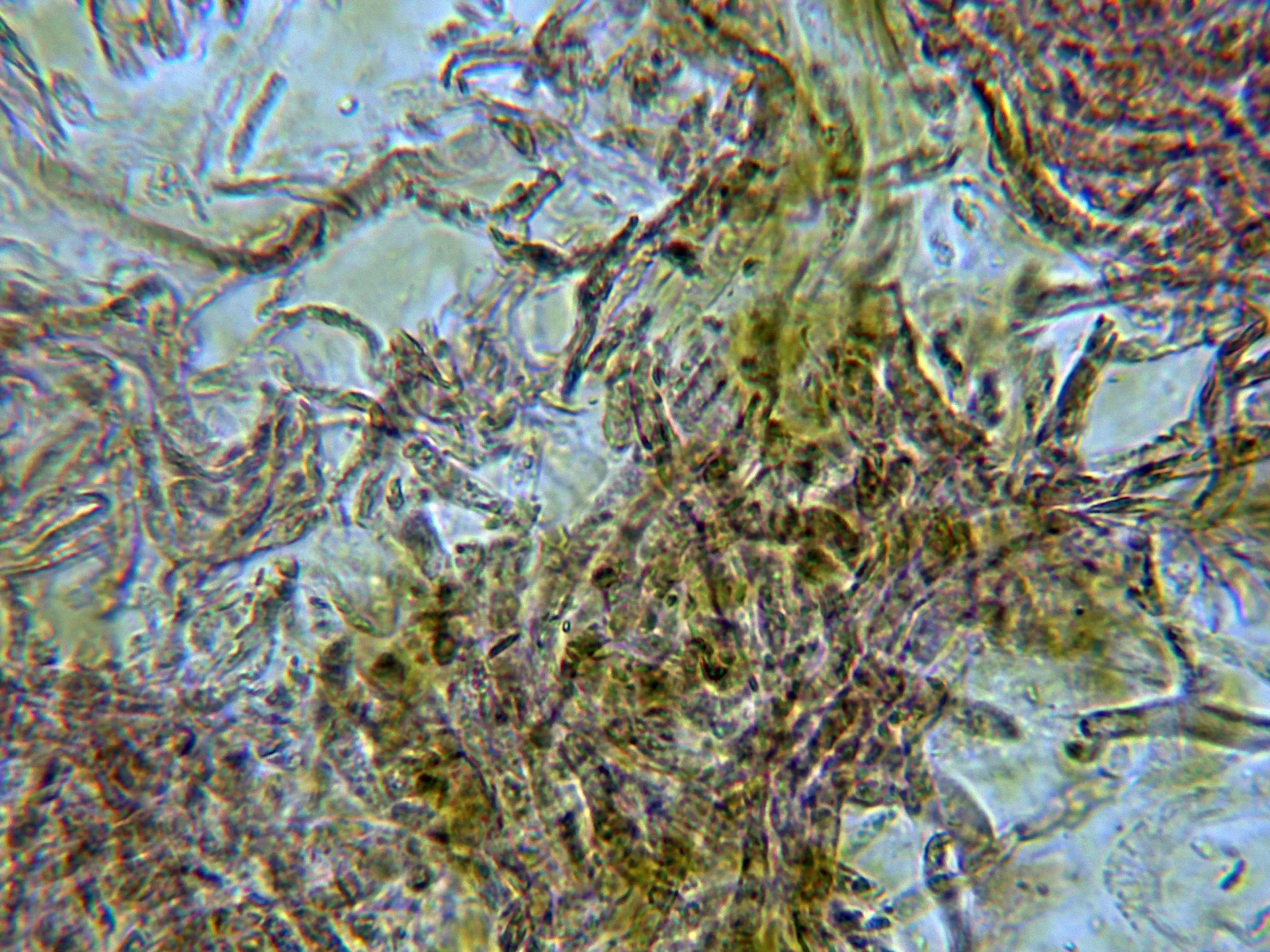 Microscopía de Pisolithus arhizus - 10 - Suprapellis frontal-001